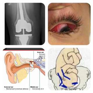Telegram profile photo for محاضرات طب بغداد للمرحلة الخامسة.