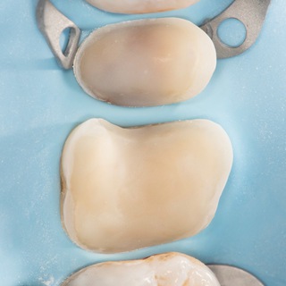 Telegram profile photo for Biomimetic Restorative Dentistry