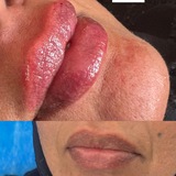 Telegram profile photo for Non-Surgical Aesthetics Course