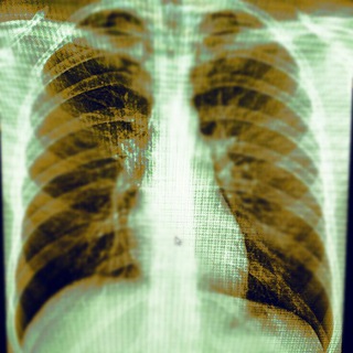 Telegram group profile photo for Radiology/Рентгенология Чат