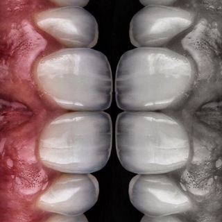 Telegram profile photo for DentUp