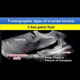 Telegram profile photo for Ultrasound discussion