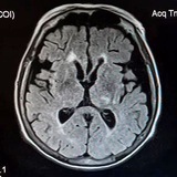 Telegram profile photo for NeurochaNnel