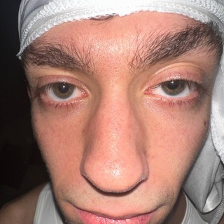 Telegram profile photo for HEMARGINAL