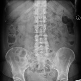 Telegram profile photo for Abdominal X-rays (AXR) Cases