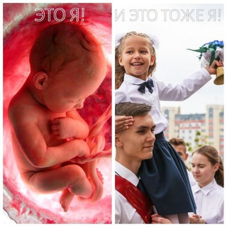 Telegram profile photo for За жизнь! За право на жизнь с момента зачатия!