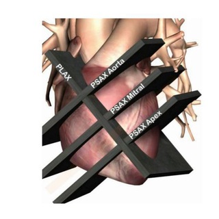 Telegram profile photo for Echocardiography