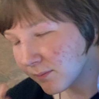 Telegram profile photo for ПРОТИВ ФЛОПАЙЛИТ