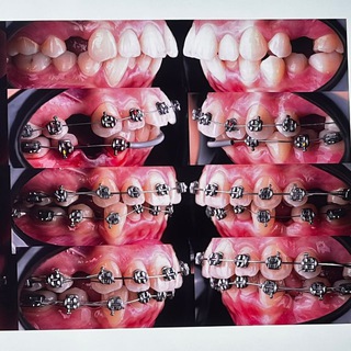 Telegram profile photo for Orthodontic clinic 🦷