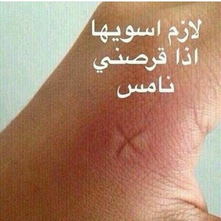 Telegram profile photo for نْڪتْ😂 يُمْنْيُه 😂 حآلَيُه