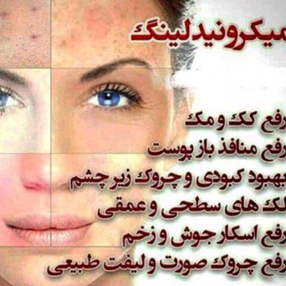 Telegram profile photo for جوانسازی پوست با میکرونیدلینگ و پاکسازی با درمااف در مارلیک و فردیس