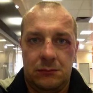 Telegram profile photo for Лысина шевченко
