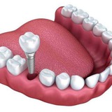 Telegram profile photo for Dental courses ⌨