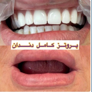 Telegram profile photo for کانال رضایت دندانسازی منتظران😍
