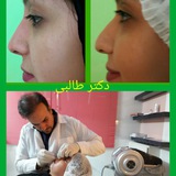 Telegram profile photo for گالری لیفت بینی وابروبانخ