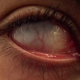 Telegram profile photo for JERK