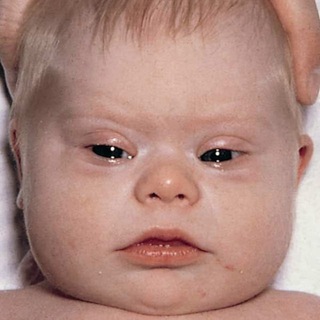 Telegram profile photo for Болезни | Патологии