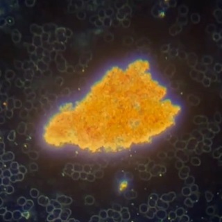 Telegram profile photo for BloodSamples