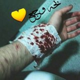 Telegram profile photo for پـًًًًحـٍّ﴿❦﴾ـة وُﺠــع ﴾ ֆ