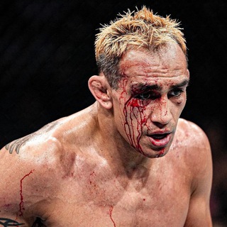 Telegram profile photo for Tony Ferguson 🕶️🔥