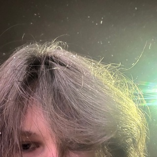 Telegram profile photo for SPAWNLOWHEMOGLOBIN!!!