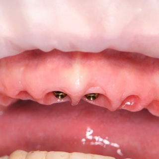 Telegram group profile photo for new teeth Chat