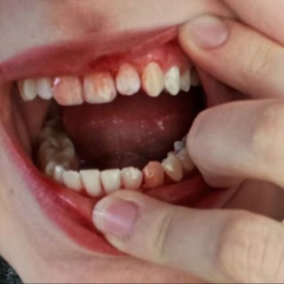 Telegram profile photo for закури, долбаеб