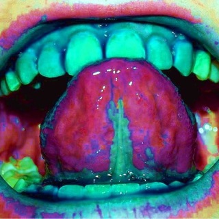 Telegram profile photo for acid ulcer info⚠️🗯°