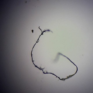 Telegram profile photo for Morgellons, Nano Worms, Sickle Worms, Fibers, Parasites