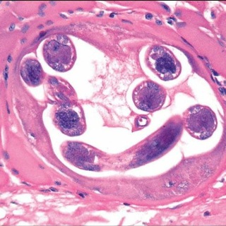 Telegram profile photo for Dr Vandana pathology telegram group