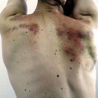Telegram profile photo for полка paralyzed