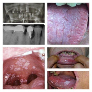Telegram profile photo for 🦷عرض حالات سريريه ومناقشتها 🦷