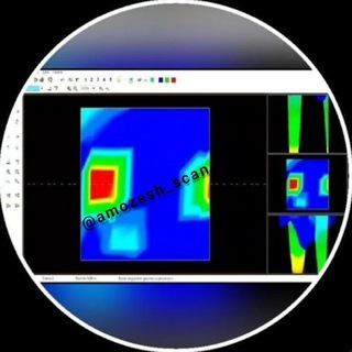 Telegram profile photo for آموزش حرفهای اسکن