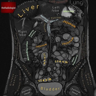 Telegram profile photo for RADIOLOGY(CT/MRI) CLASS
