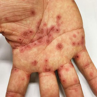 Telegram profile photo for Temel Dermatoloji Vaka