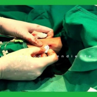 Telegram profile photo for Artículos acceso vascular elenfermerodelpendiente