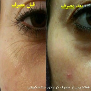 Telegram profile photo for PMLM < before - after >