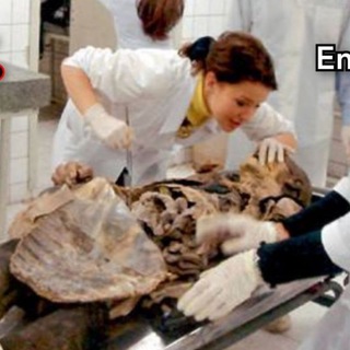 Telegram profile photo for MORFOLOGÍA (Anatomía, Histología y Embriología)