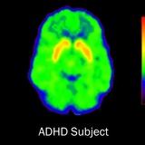 Telegram profile photo for SDVG(ADHD), Blackpill, Science && Shitposting
