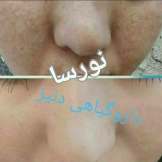 Telegram profile photo for داروگیاهی دنیزمحصولات اورجینال