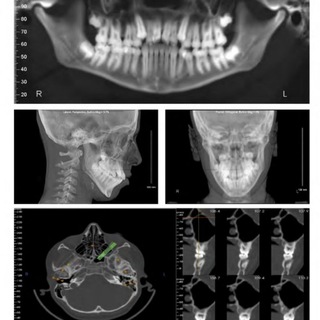 Telegram profile photo for Prometric Orthodontics