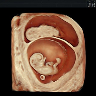 Telegram profile photo for 3D & 4D Ultrasound