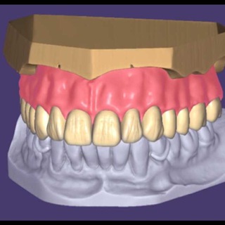 Telegram profile photo for exocad-3shape-cerec expert