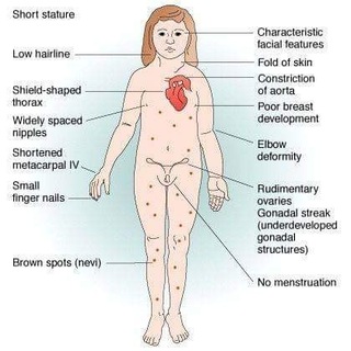 Telegram profile photo for Turner Syndrome Society