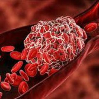 Telegram profile photo for Hematology system