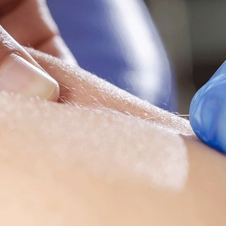 Telegram profile photo for Dry Needling_Q8