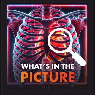 Telegram profile photo for Что по снимку скажешь?