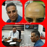 Telegram profile photo for clinicsepahan کاشت مو و ابرو