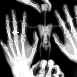 Telegram profile photo for بلوك عظام orthopedics