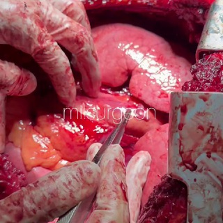 Telegram profile photo for milsurgeon